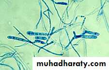 Fungal Infections