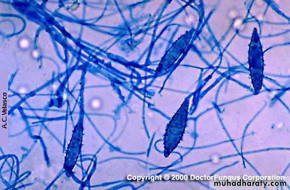 Fungal Infections