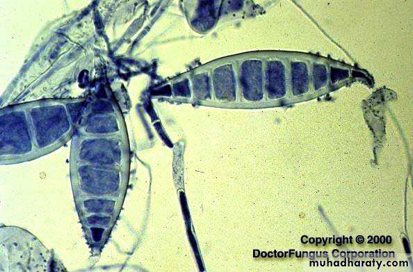 Fungal Infections