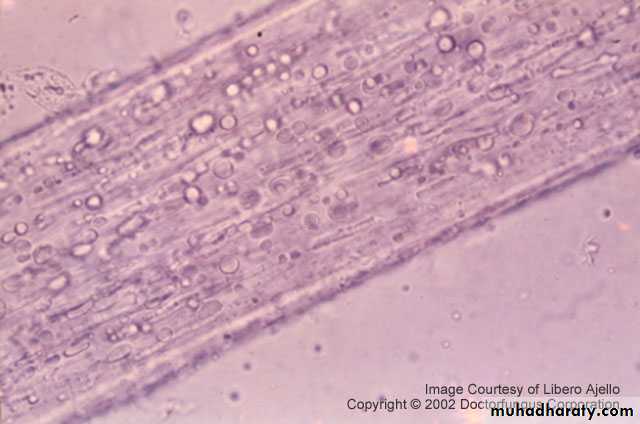Fungal Infections