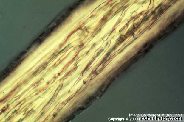 Fungal Infections