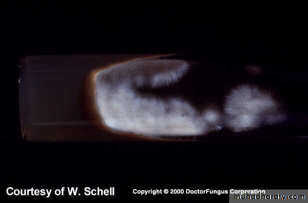 Fungal Infections