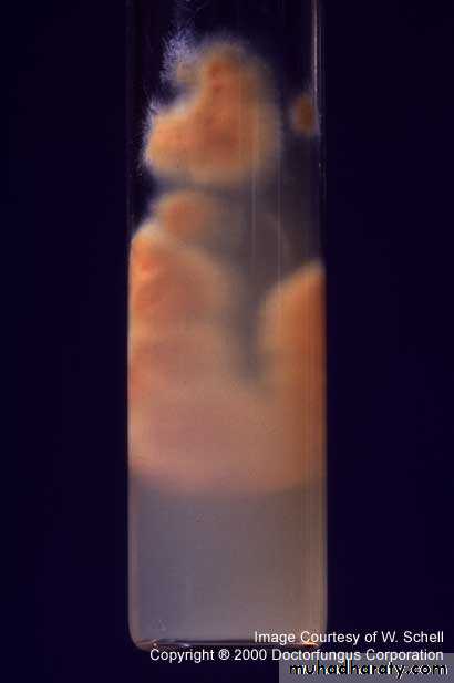 Fungal Infections