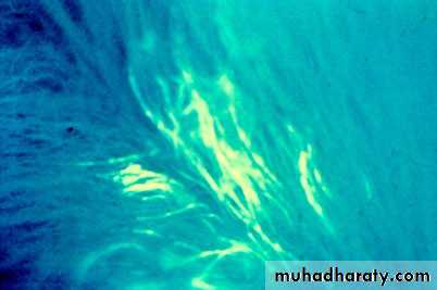 Fungal Infections