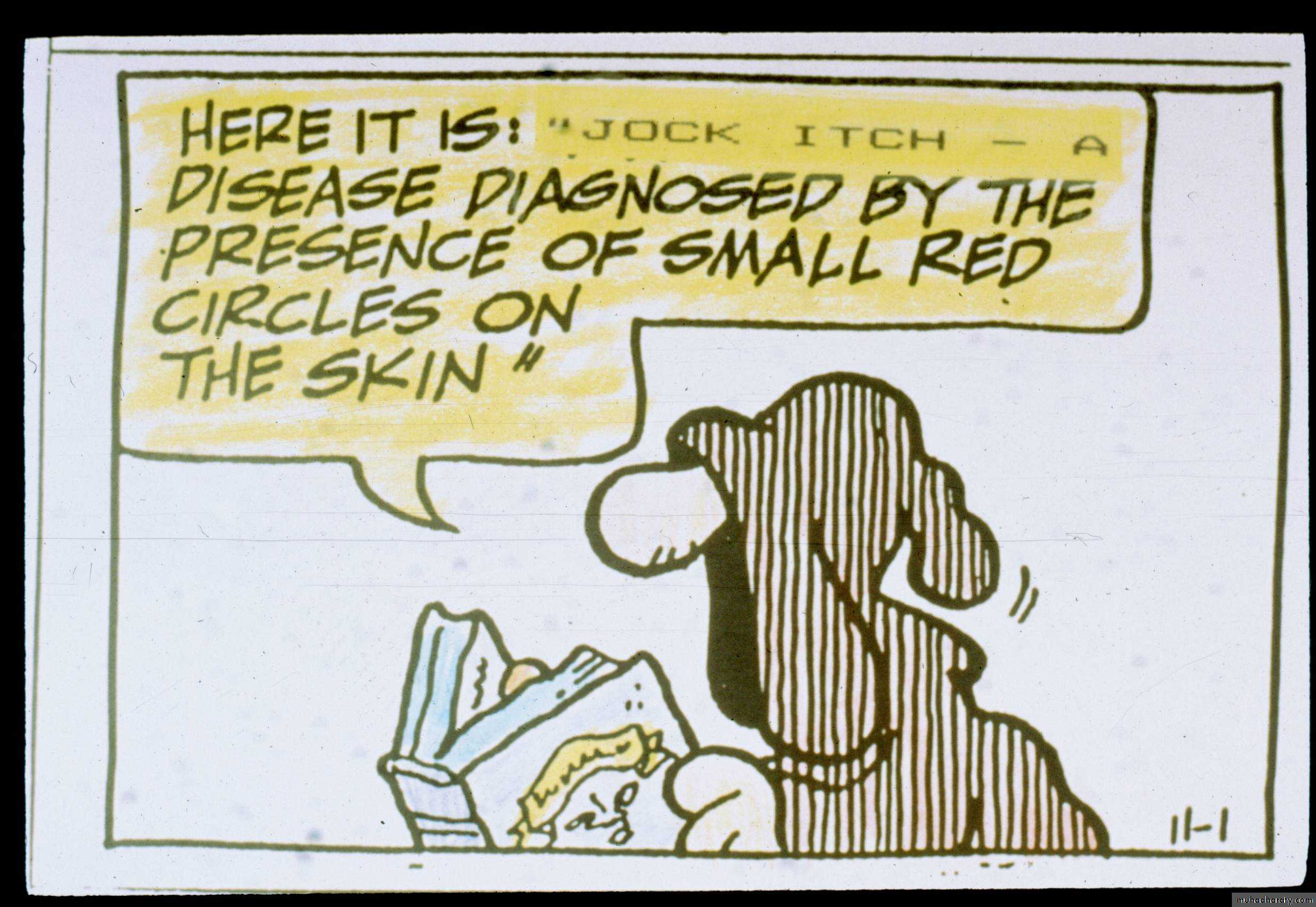 Fungal Infections