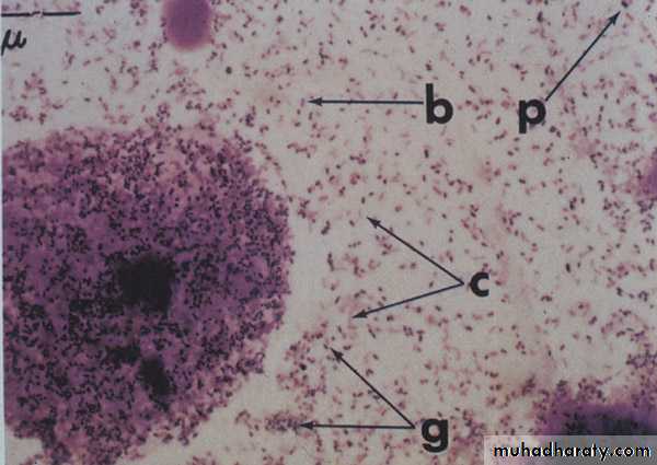 Vaginal diseases