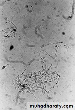 Vaginal diseases