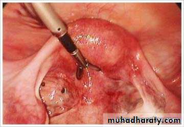 Menstruation
