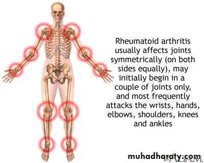 Rheumatoid arthritis