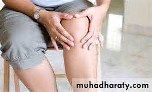 Osteoarthritis