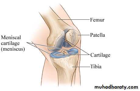 Osteoarthritis