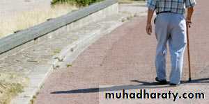 Osteoarthritis
