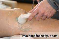 Osteoarthritis