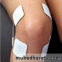 Osteoarthritis