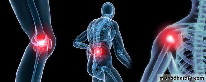Osteoarthritis