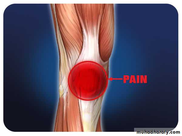 Osteoarthritis