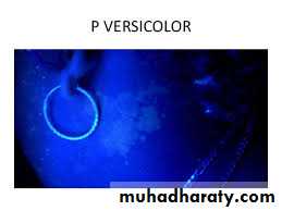 Diagnosis of skin disorders