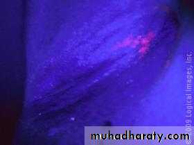 Diagnosis of skin disorders