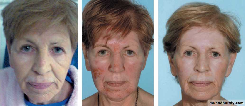 Diagnosis of skin disorders