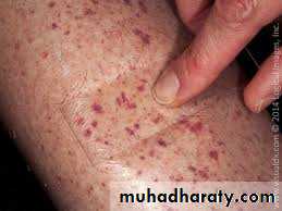 Diagnosis of skin disorders