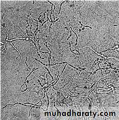 Diagnosis of skin disorders