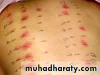 Diagnosis of skin disorders
