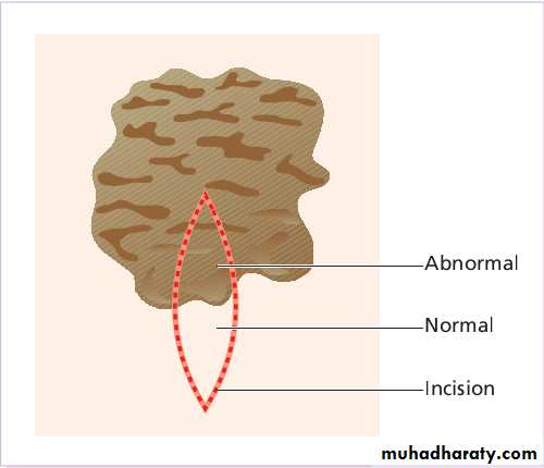 Diagnosis of skin disorders
