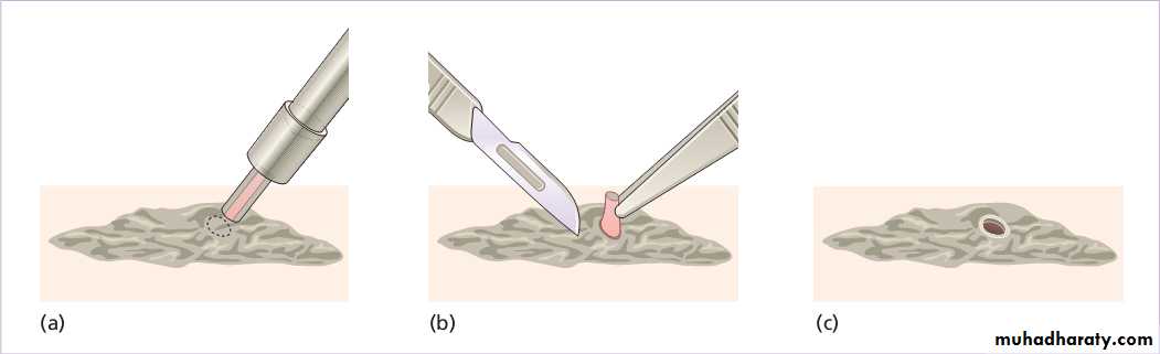 Diagnosis of skin disorders