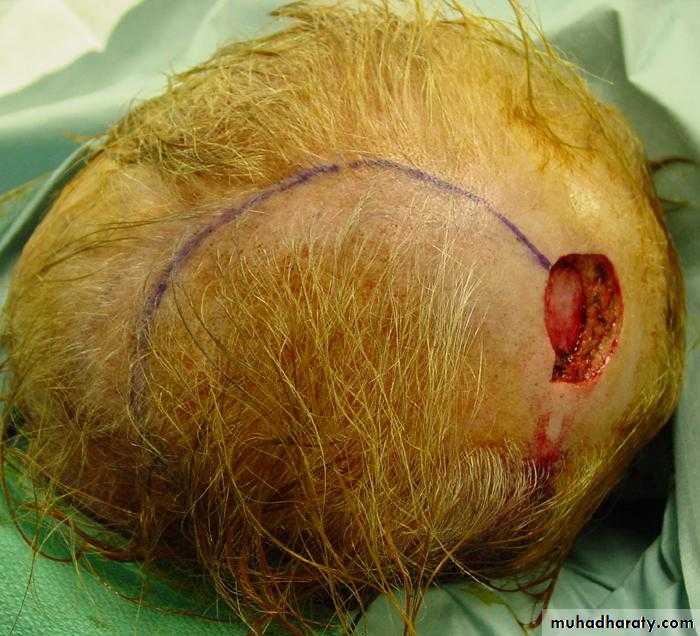 Basic principles in plastic surgery