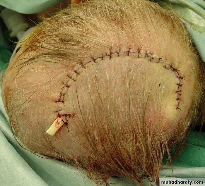 Basic principles in plastic surgery