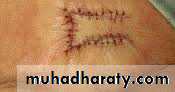 Basic principles in plastic surgery