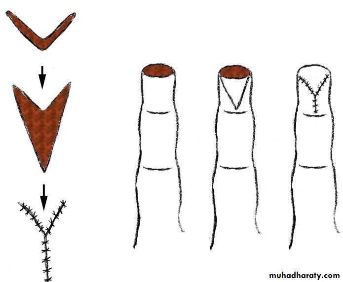 Basic principles in plastic surgery