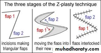 Basic principles in plastic surgery