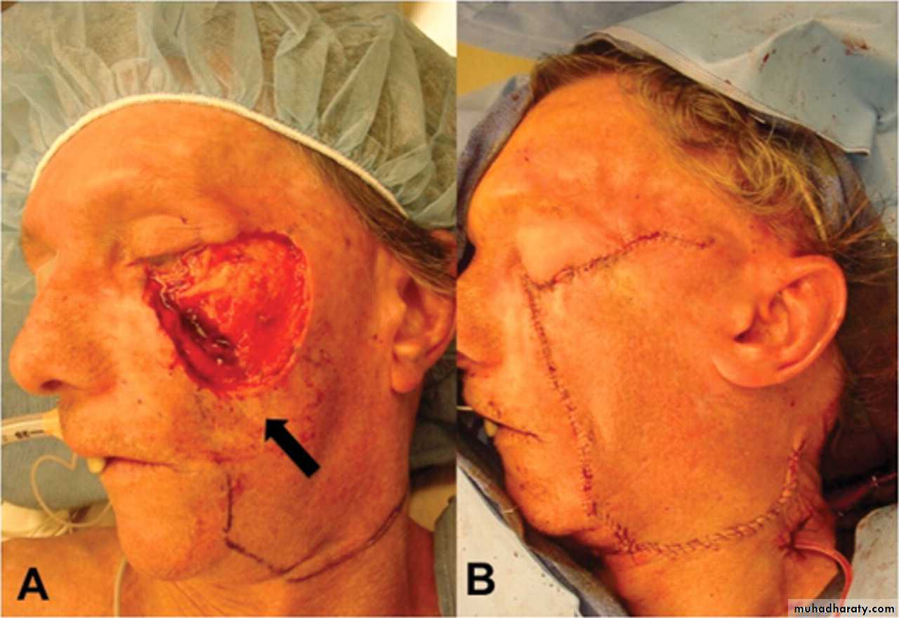 Basic principles in plastic surgery