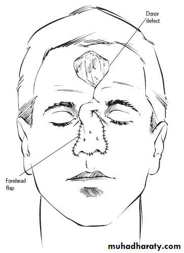 Basic principles in plastic surgery