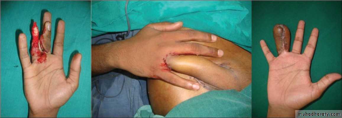 Basic principles in plastic surgery