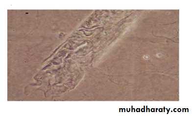 approach to renal disease