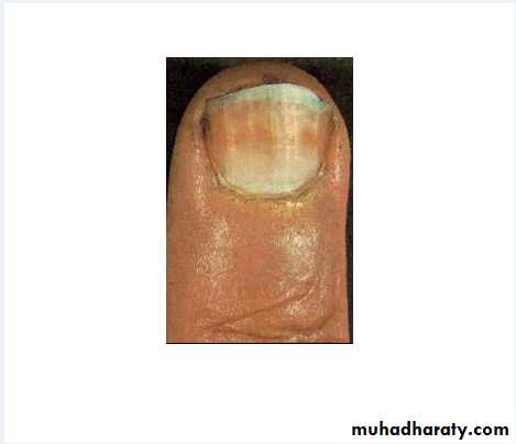 approach to renal disease