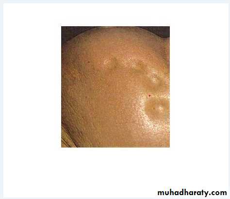 approach to renal disease