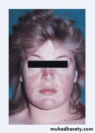 approach to renal disease
