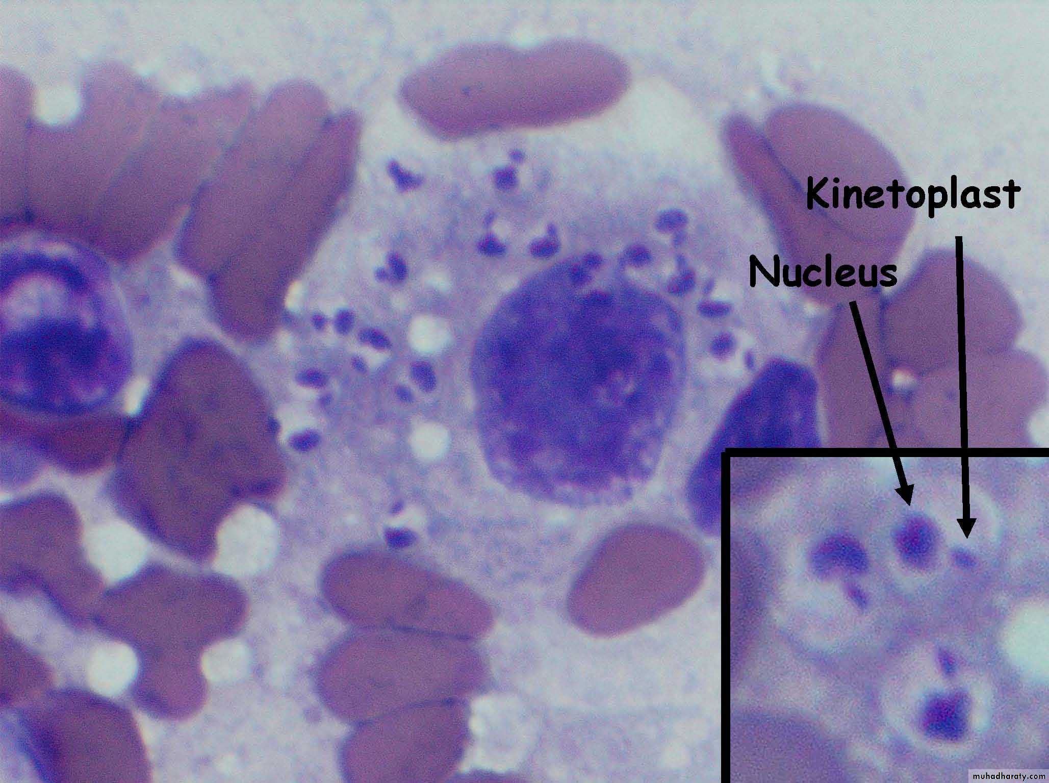 parasitic skin diseases