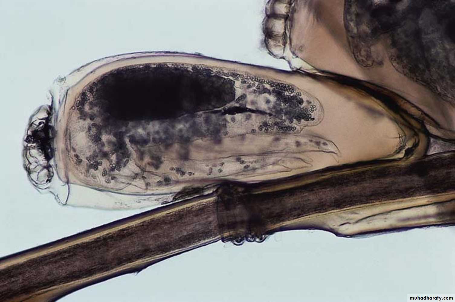 parasitic skin diseases