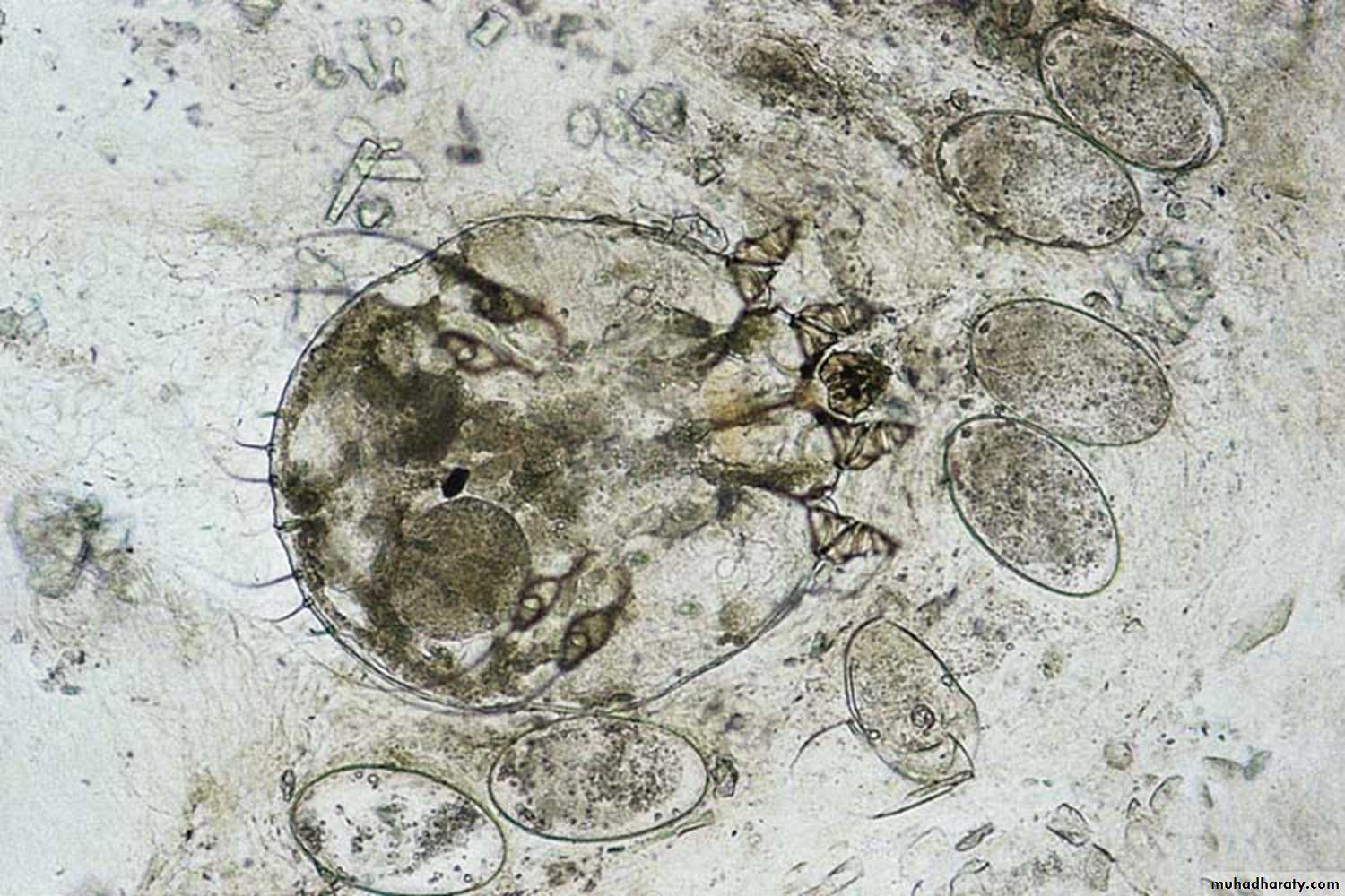 parasitic skin diseases