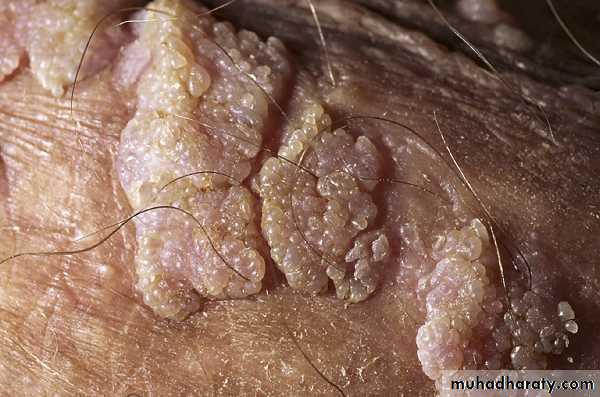Viral skin diseases