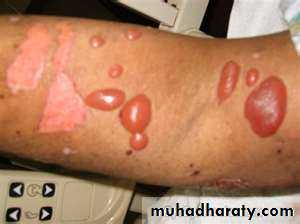 skin appendages