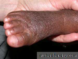 skin appendages