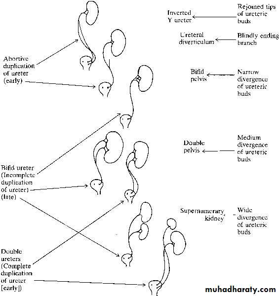Congenital anomalies of the upper urinary tract