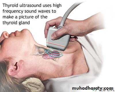 Thyroid gland