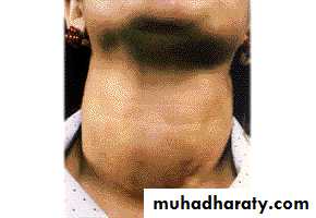 Thyroid gland