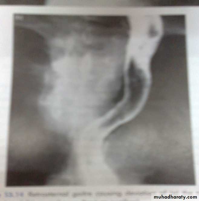 Thyroid gland